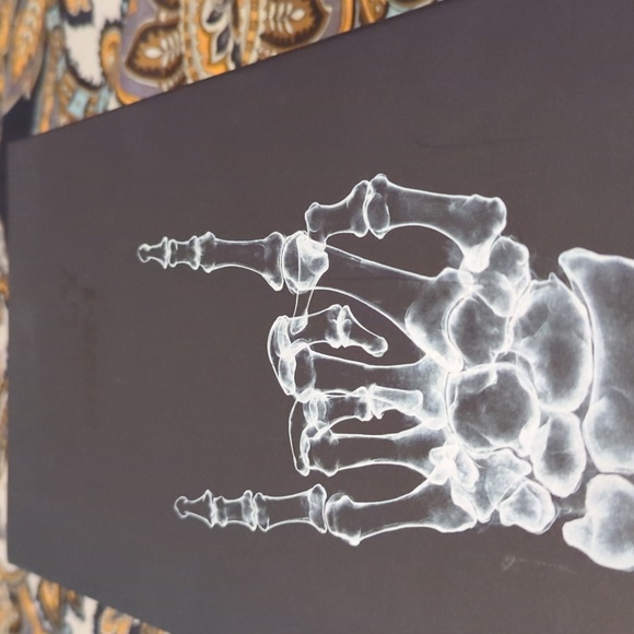 Bally - Picture 7 of 7